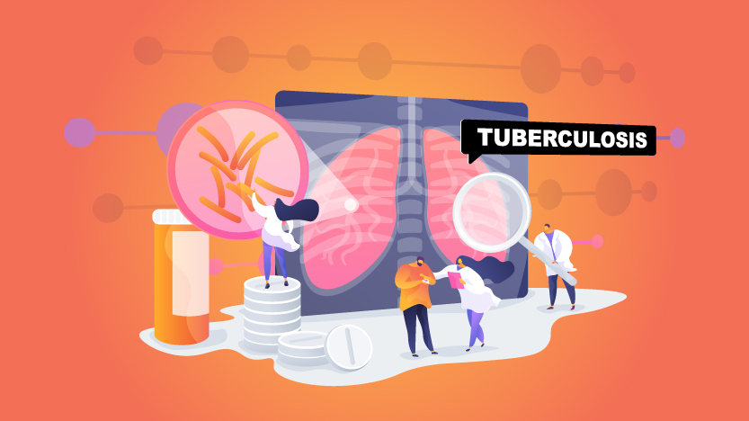 Answering common questions and doubts about Tuberculosis